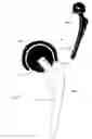 Fig. 02 - Cartilage-preserving long bone head prosthesis