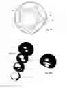 Fig. 06 - Cartilage-preserving long bone head prosthesis
