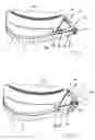 Fig. 07 - Tibial cement skirt assembly