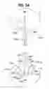 Fig. 03 - Ureteral stent with conforming retention structure