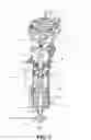 Fig. 09 - Artificial knee with cushion function