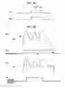 Fig. 32 - Specific-condition-section detection apparatus and method of detecting specific condition section