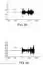 Fig. 10 - Method of detecting the position of a wave front in a signal received by a detector