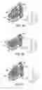 Fig. 09 - Somatic embryogenesis and embryo harvesting and method and apparatus for preparing plant embryos for plant production