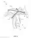 Fig. 05 - Convertible hand covering system