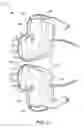 Fig. 06 - Convertible hand covering system