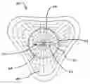 Fig. 01 - ANTI-SPLASH DEVICE FOR FIXTURES
