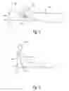 Fig. 04 - Anti-snoring pillow