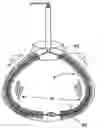 Fig. 01 - Expandable cleaning brush