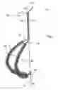 Fig. 02 - Expandable cleaning brush