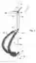 Fig. 03 - Expandable cleaning brush