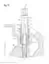 Fig. 10 - Tool system for replacing a glow plug of a diesel engine