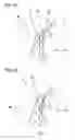 Fig. 08 - Method of producing applicator tip