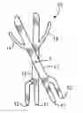 Fig. 01 - Hinged fork apparatus and method