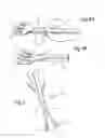 Fig. 03 - Hinged fork apparatus and method