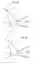 Fig. 04 - Adjustable fishing lure and method of manufacturing the lure