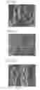 Fig. 22 - Connecting rod and internal combustion engine and automotive vehicle incorporating the same