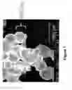 Fig. 02 - Biocompatible cement containing reactive calcium phosphate nanoparticles and methods for making and using such cement