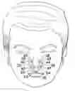 Fig. 01 - Nasal appliance