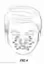 Fig. 03 - Nasal appliance