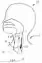 Fig. 02 - Methods and systems for tracheal access and ventilation