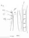 Fig. 04 - Methods and systems for tracheal access and ventilation