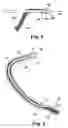Fig. 04 - Articles, devices, and methods for pelvic surgery