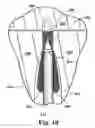 Fig. 08 - Articles, devices, and methods for pelvic surgery