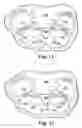 Fig. 09 - Articles, devices, and methods for pelvic surgery