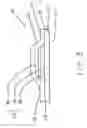 Fig. 04 - Operating room equipment drapes and methods of making and using the same