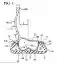 Fig. 02 - Tire/wheel assembly and run-flat support member