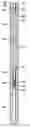Fig. 01 - Downhole connection system