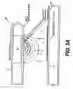 Fig. 03 - Apparatus and method for isolating materials