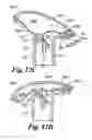 Fig. 16 - Nozzle devices
