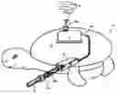 Fig. 01 - Water discharging devices