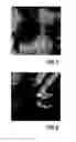 Fig. 06 - Feedback influenced increased-quality-factor scanning probe microscope