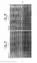 Fig. 02 - Touching microlens structure for a pixel sensor and method of fabrication