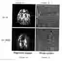 Fig. 06 - Method for imaging diffusion anisotropy and diffusion gradient simultaneously