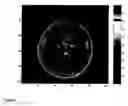 Fig. 07 - Method for imaging diffusion anisotropy and diffusion gradient simultaneously