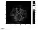 Fig. 08 - Method for imaging diffusion anisotropy and diffusion gradient simultaneously
