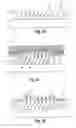 Fig. 04 - Apparatus and method for limiting over travel in a probe card assembly