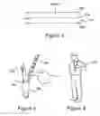 Fig. 03 - Linear pressure sensor