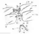 Fig. 01 - Eyeglass set with sunglass clip