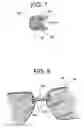 Fig. 04 - Eyeglass set with sunglass clip