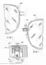 Fig. 02 - Eyeglass frame adapted for the removal and insertion of lenses