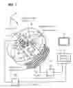 Fig. 02 - Radiation diaphragm in device having two diaphragms, and method for scanning a subject therewith