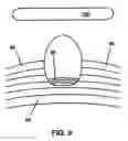 Fig. 10 - Area earthquake defense system
