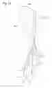 Fig. 12 - Segmented vertical axis air rotor and wind generator apparatus