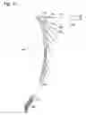 Fig. 20 - Segmented vertical axis air rotor and wind generator apparatus