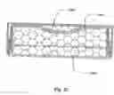 Fig. 50 - Use of a metal and Sn as a solvent material for the bulk crystallization and sintering of diamond to produce biocompatbile biomedical devices